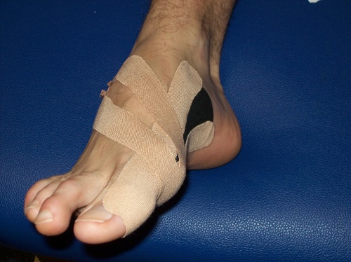K-Taping
